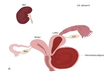 EC GYNAECOLOGY