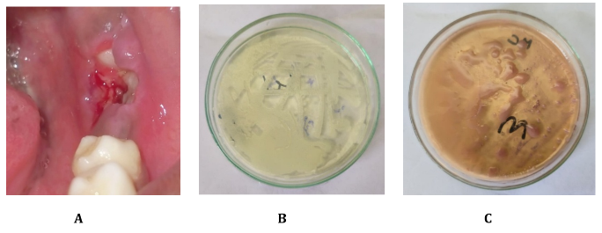 EC Microbiology